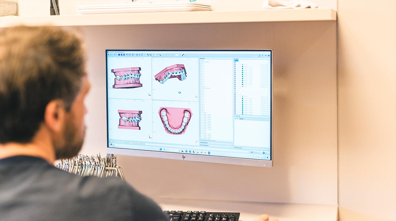 Individuelle Zahnspangen von Dr. Uwe Seidl – in Regensburg und Umgebung Individuelle Zahnspangen von Dr. Uwe Seidl - Kieferorthopädie für Regensburg und Umgebung