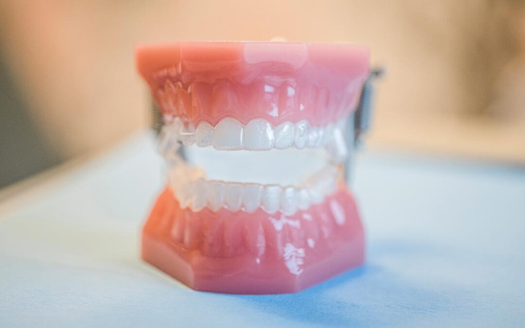 Geschützt: Aligner reinigen – So bleiben Ihre Zahnschienen hygienisch sauber